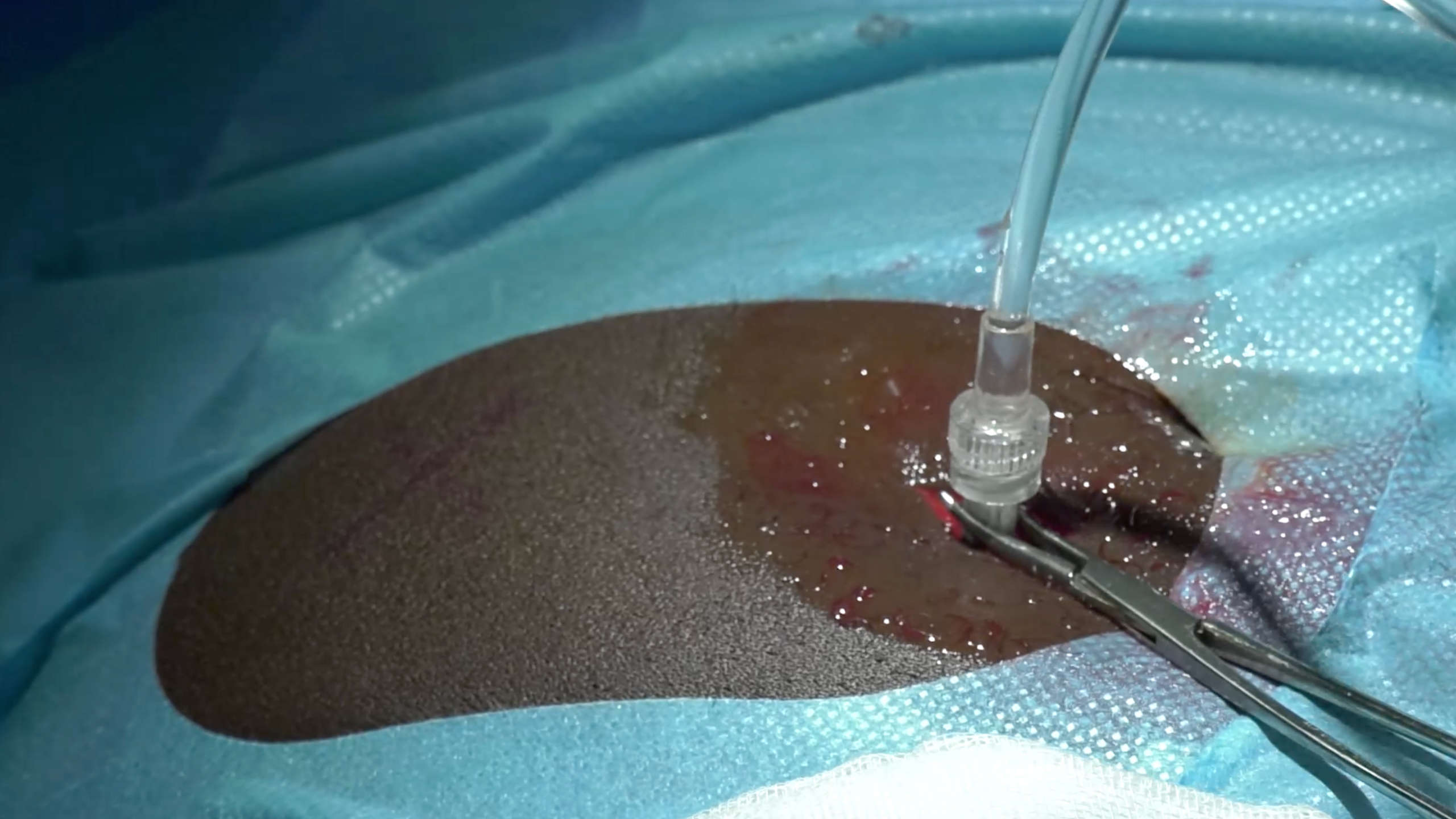 Image for task: Fluid Drain Test