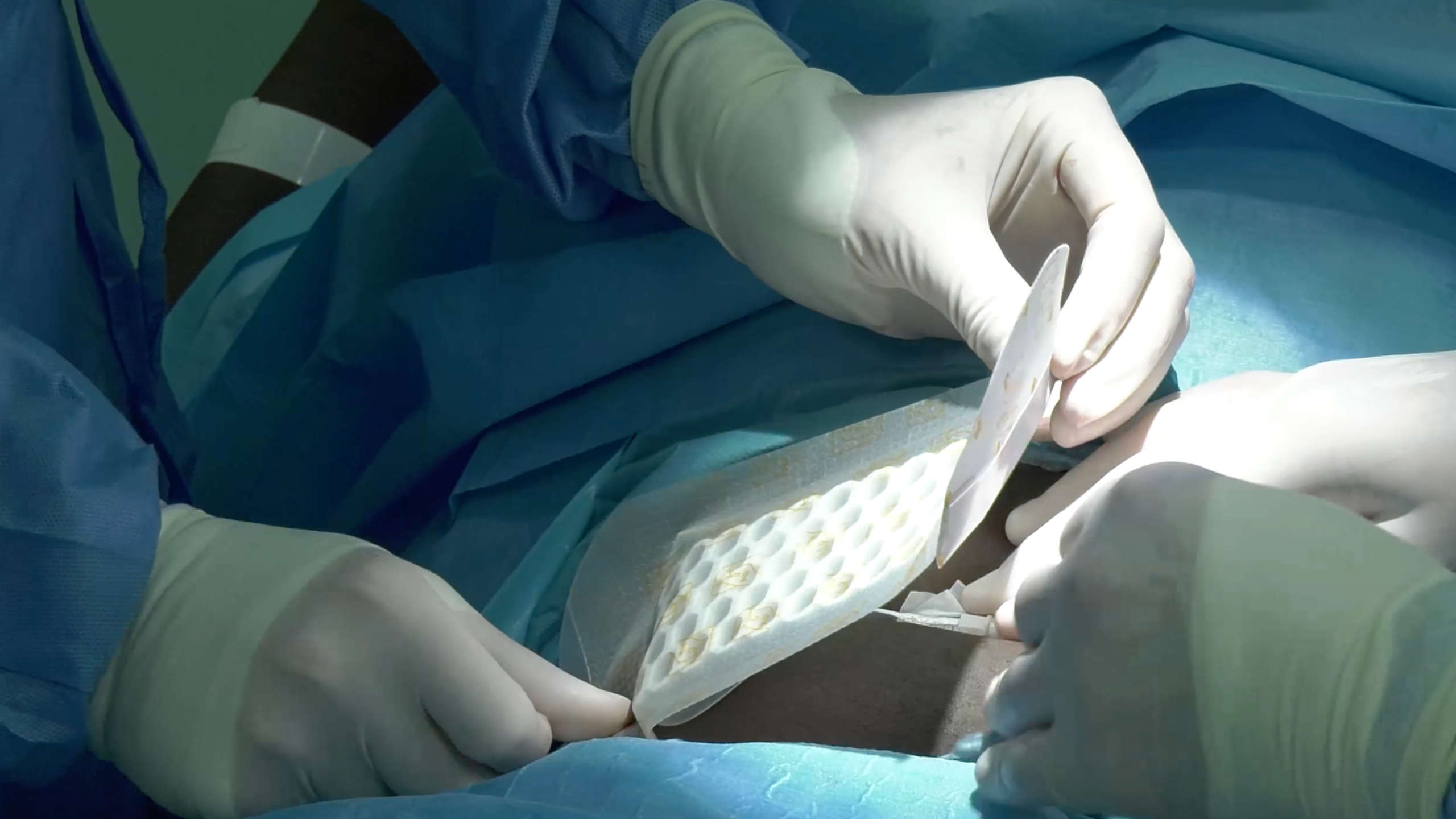 Image for task: Stitching and Wound Dressing