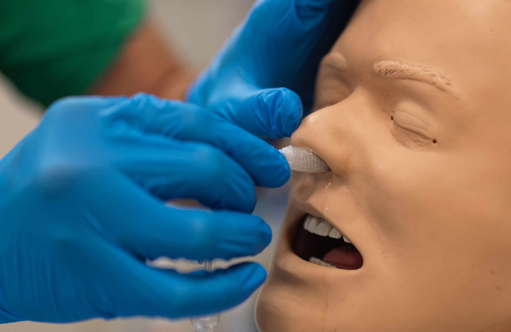 Image previewing the Epistaxis Management - Nasal Packing task