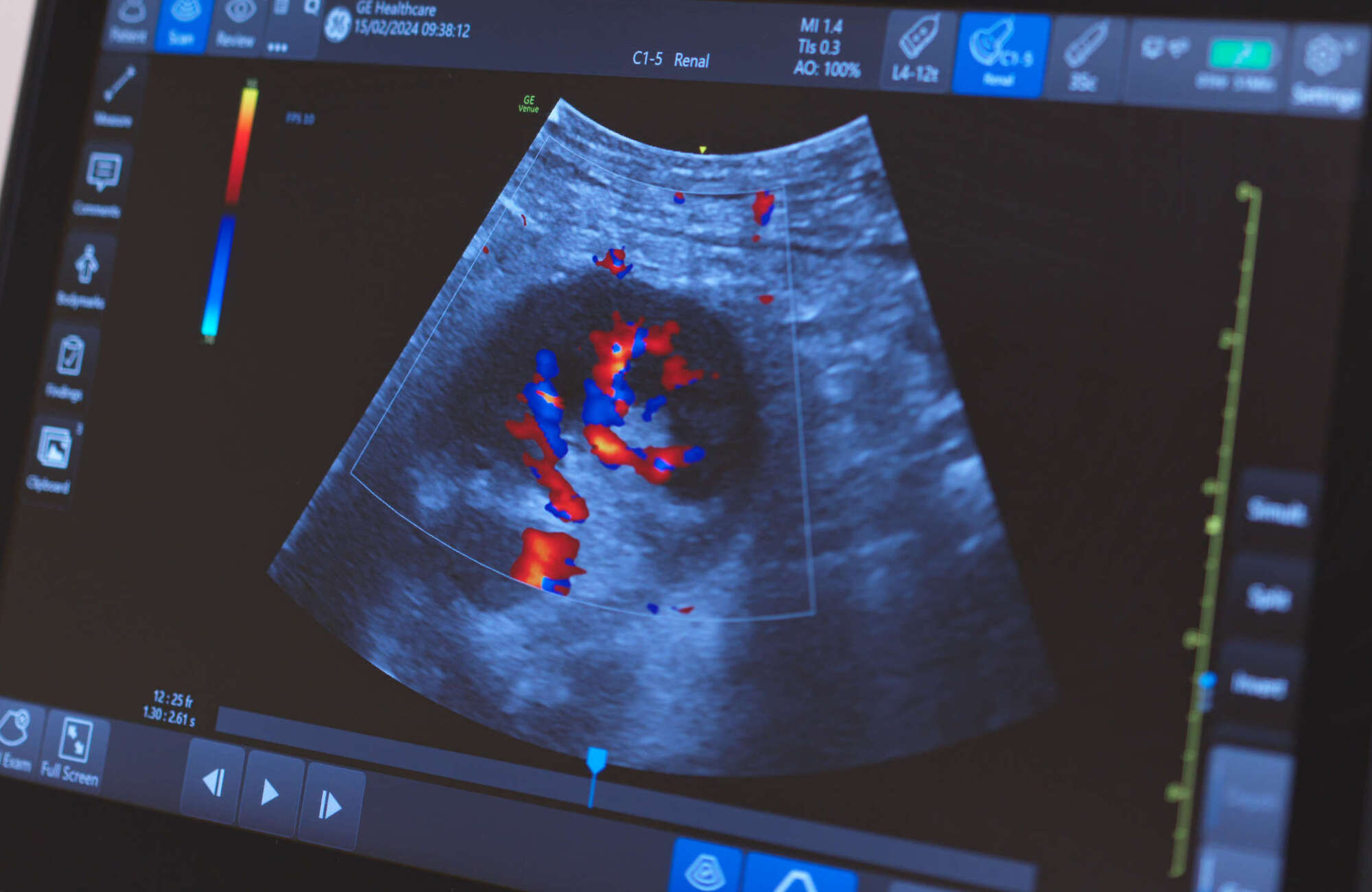 Image previewing the Native Biopsy - 1 task