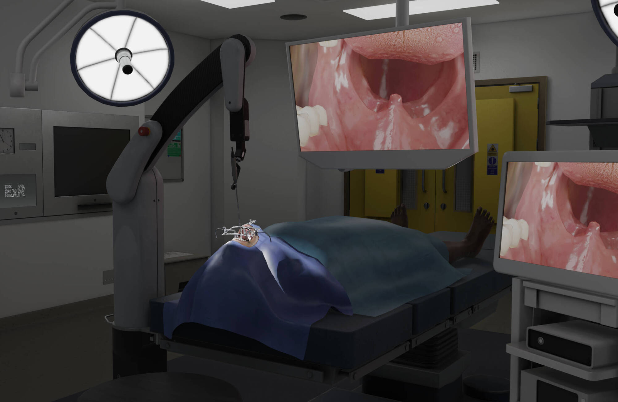 Image previewing the Transoral Dissection task
