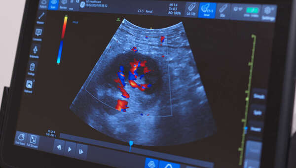 Image previewing the Native Biopsy - 1 task